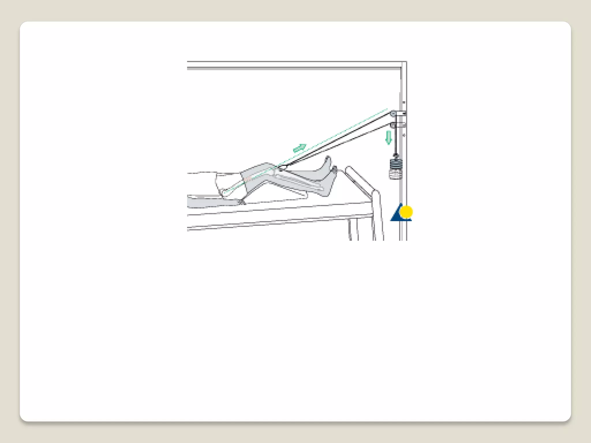 Splints and tractions