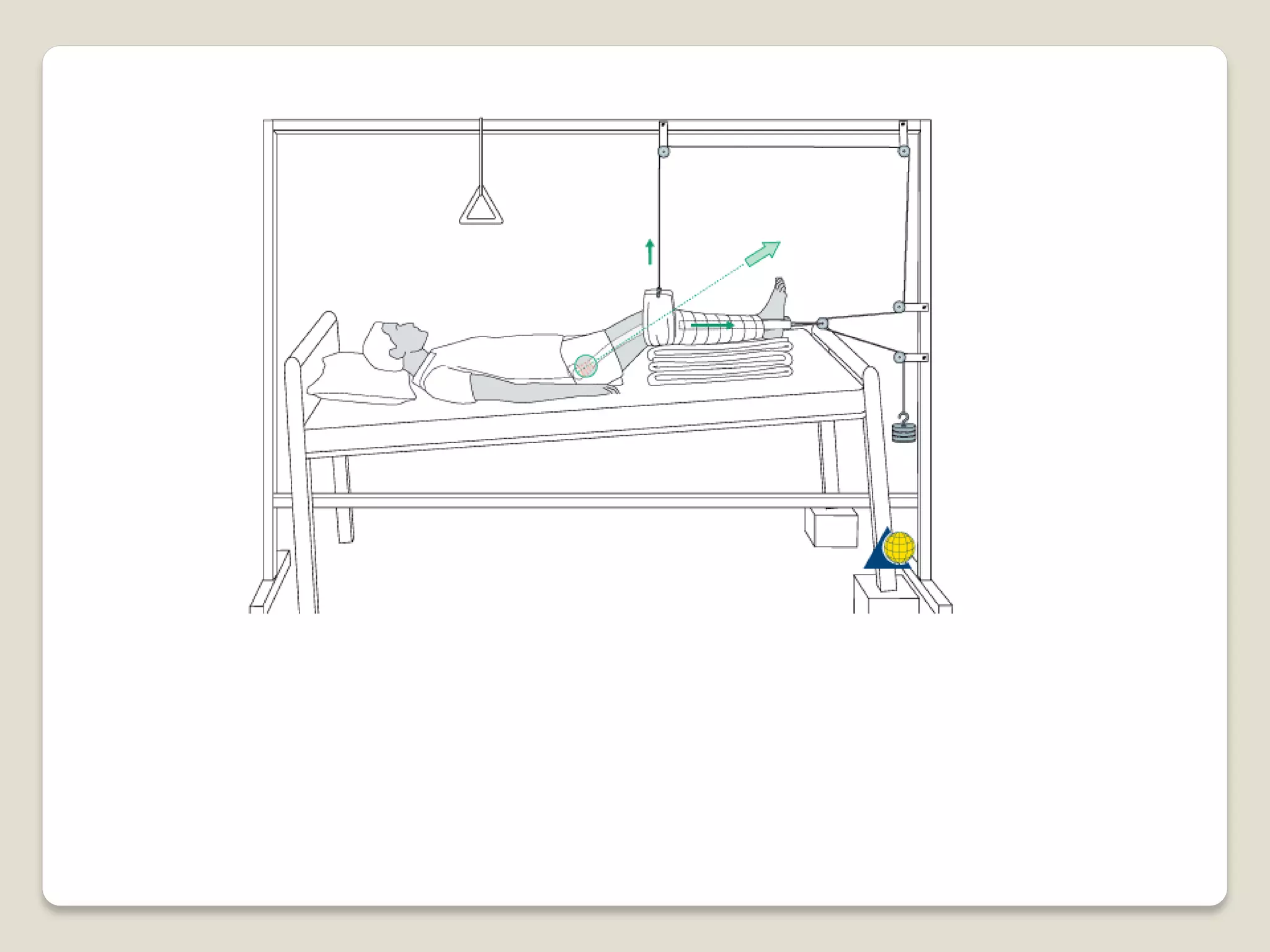 Splints and tractions