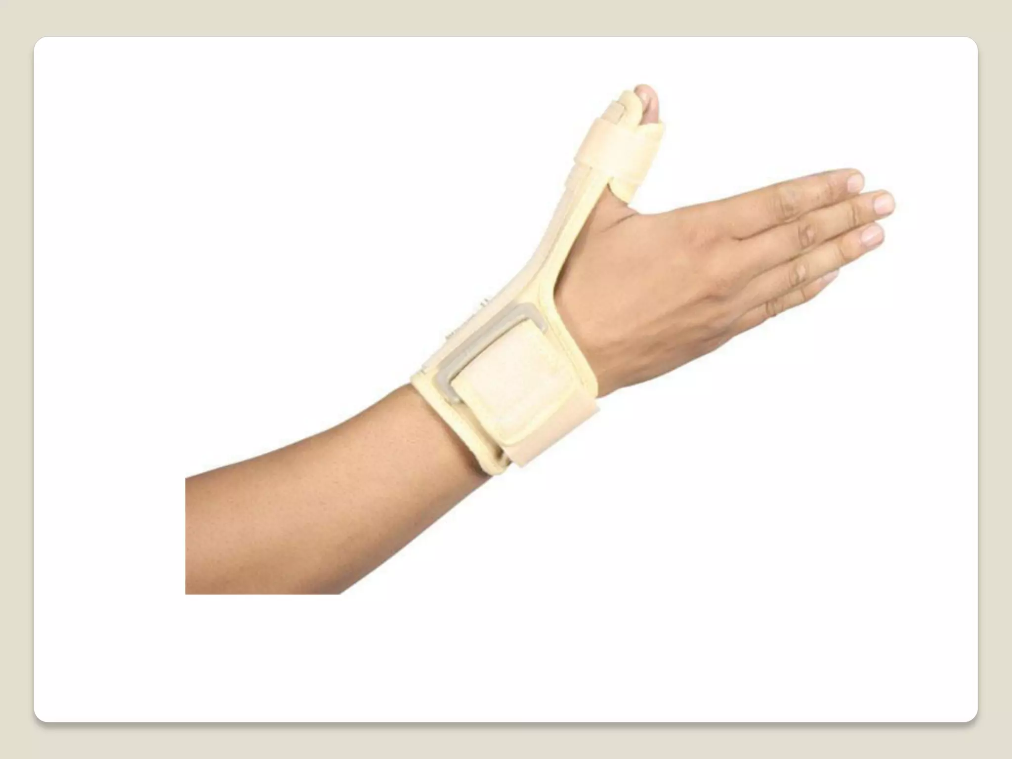 Splints and tractions