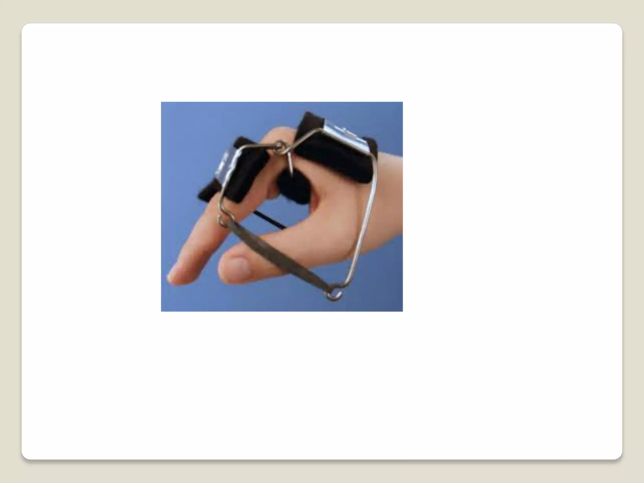 Splints and tractions