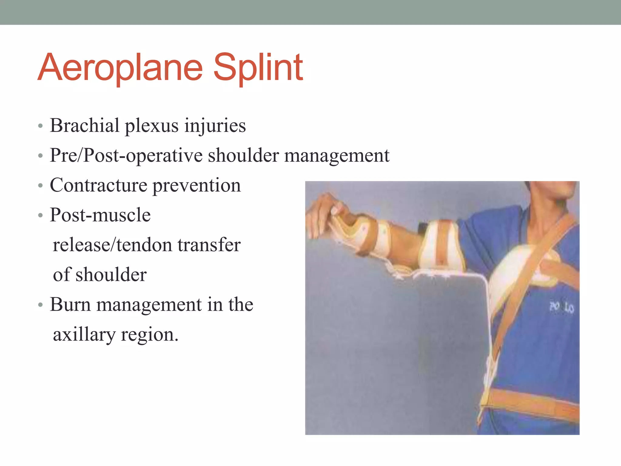 Aeroplane Splint
• Brachial plexus injuries
• Pre/Post-operative shoulder management
• Contracture prevention
• Post-muscle
release/tendon transfer
of shoulder
• Burn management in the
axillary region.
 