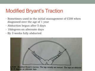 Modified Bryant’s Traction
• Sometimes used in the initial management of CDH when
diagnosed over the age of 1 year
• Abduction begun after 5 days
• 10degrees on alternate days
• By 3 weeks fully abducted
 