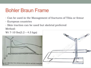 Bohler Braun Frame
• Can be used in the Management of fractures of Tibia or femur
• European countries
• Skin traction can be used but skeletal preferred
Method:
Wt 7-10 lbs(3.2 – 4.5 kgs)
 