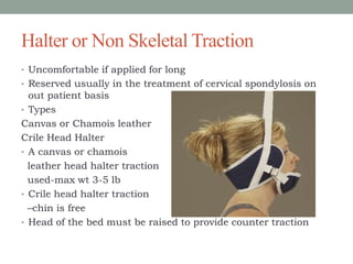 Halter or Non Skeletal Traction
• Uncomfortable if applied for long
• Reserved usually in the treatment of cervical spondylosis on
out patient basis
• Types
Canvas or Chamois leather
Crile Head Halter
• A canvas or chamois
leather head halter traction
used-max wt 3-5 lb
• Crile head halter traction
–chin is free
• Head of the bed must be raised to provide counter traction
 
