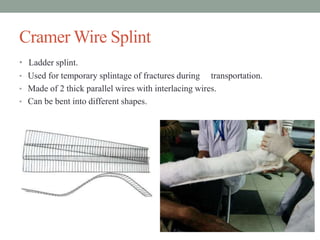 Cramer Wire Splint
• Ladder splint.
• Used for temporary splintage of fractures during transportation.
• Made of 2 thick parallel wires with interlacing wires.
• Can be bent into different shapes.
 