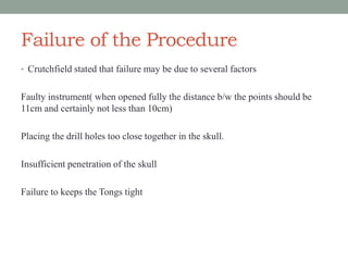 Failure of the Procedure
• Crutchfield stated that failure may be due to several factors
Faulty instrument( when opened fully the distance b/w the points should be
11cm and certainly not less than 10cm)
Placing the drill holes too close together in the skull.
Insufficient penetration of the skull
Failure to keeps the Tongs tight
 