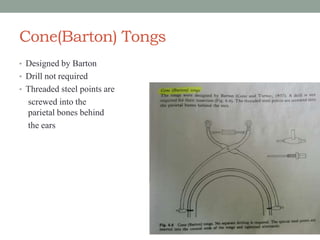 Cone(Barton) Tongs
• Designed by Barton
• Drill not required
• Threaded steel points are
screwed into the
parietal bones behind
the ears
 