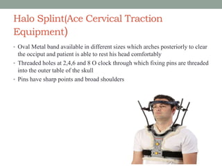 Halo Splint(Ace Cervical Traction
Equipment)
• Oval Metal band available in different sizes which arches posteriorly to clear
the occiput and patient is able to rest his head comfortably
• Threaded holes at 2,4,6 and 8 O clock through which fixing pins are threaded
into the outer table of the skull
• Pins have sharp points and broad shoulders
 