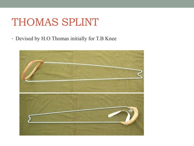 Splints and tractions | PPTX
