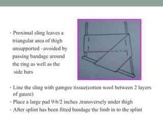 • Proximal sling leaves a
triangular area of thigh
unsupported –avoided by
passing bandage around
the ring as well as the
side bars
• Line the sling with gamgee tissue(cotton wool between 2 layers
of gauze)
• Place a large pad 9/6/2 inches ,transversely under thigh
• After splint has been fitted bandage the limb in to the splint
 