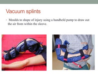 Vacuum splints
• Moulds to shape of injury using a handheld pump to draw out
the air from within the sleeve.
 