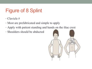 Figure of 8 Splint
• Clavicle #
• Most are prefabricated and simple to apply
• Apply with patient standing and hands on the iliac crest
• Shoulders should be abducted
 