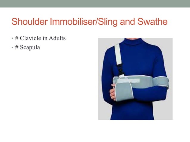 Splints and tractions | PPTX