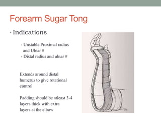 Forearm Sugar Tong
• Indications
- Unstable Proximal radius
and Ulnar #
- Distal radius and ulnar #
Extends around distal
humerus to give rotational
control
Padding should be atleast 3-4
layers thick with extra
layers at the elbow
 