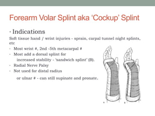 Forearm Volar Splint aka ‘Cockup’ Splint
• Indications
Soft tissue hand / wrist injuries - sprain, carpal tunnel night splints,
etc
• Most wrist #, 2nd -5th metacarpal #
• Most add a dorsal splint for
increased stability - ‘sandwich splint’ (B).
• Radial Nerve Palsy
• Not used for distal radius
or ulnar # - can still supinate and pronate.
 