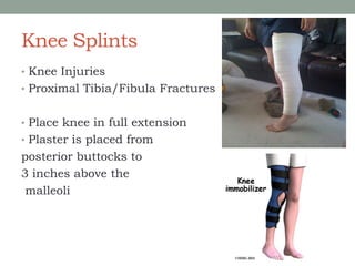 Knee Splints
• Knee Injuries
• Proximal Tibia/Fibula Fractures
• Place knee in full extension
• Plaster is placed from
posterior buttocks to
3 inches above the
malleoli
 