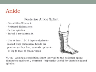Ankle
Posterior Ankle Splint
• Distal tibia/fibula #.
• Reduced dislocations
• Severe sprains
• Tarsal / metatarsal fx
• Use at least 12-15 layers of plaster
placed from metatarsal heads on
plantar surface foot, extends up back
of leg to level of fibular neck
NOTE - Adding a coaptation splint (stirrup) to the posterior splint
eliminates inversion / eversion - especially useful for unstable fx and
sprains.
 