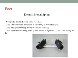 Foot
Dennis Brown Splint
• Congenital Talipes Equino Varus (C.T.E.V.)
• Used after successful correction of deformity to prevent relapse.
• Used throughout the day before child starts walking.
• Once child starts walking ,a DB splints is used at night and CTEV shoes during the
day.
 