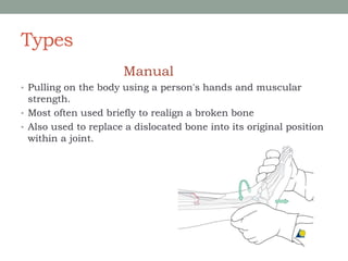 Types
Manual
• Pulling on the body using a person's hands and muscular
strength.
• Most often used briefly to realign a broken bone
• Also used to replace a dislocated bone into its original position
within a joint.
 