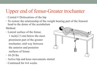 Upper end of femur-Greater trochanter
• Central # Dislocations of the hip
• To restore the relationship of the weight bearing part of the femoral
head to the dome of the acetabulum
Method:
• Lateral surface of the femur,
1 inch(2.5 cm) below the most
prominent part of the greater
trochanter, mid way between
the anterior and posterior
surfaces of femur.
• 10-20 lbs
• Active hip and knee movements started
• Continued for 4-6 weeks
 