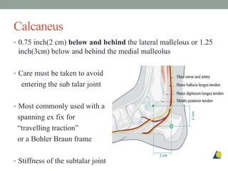 Calcaneus
• 0.75 inch(2 cm) below and behind the lateral mallelous or 1.25
inch(3cm) below and behind the medial malleolus
• Care must be taken to avoid
entering the sub talar joint
• Most commonly used with a
spanning ex fix for
“travelling traction”
or a Bohler Braun frame
• Stiffness of the subtalar joint
 