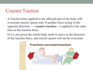 Counter Traction
• A Traction force applied to the affected part of the body will
overcome muscle spasm only if another force acting in the
opposite direction --- counter traction--- is applied at the same
time as the traction force.
• If it is not given the whole body tends to move in the direction
of the traction force, and muscle spasm will not be overcome
 