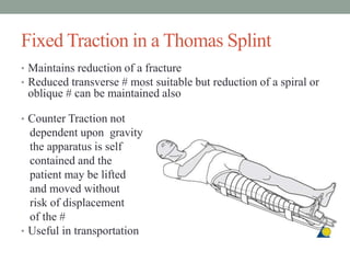 Fixed Traction in a Thomas Splint
• Maintains reduction of a fracture
• Reduced transverse # most suitable but reduction of a spiral or
oblique # can be maintained also
• Counter Traction not
dependent upon gravity
the apparatus is self
contained and the
patient may be lifted
and moved without
risk of displacement
of the #
• Useful in transportation
 