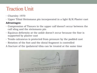 Traction Unit
• Charnley 1970
• Upper Tibial Steinmann pin incorporated in a light B/K Plaster cast
Advantages:
• Compression of Tissues in the upper calf doesn’t occur between the
calf sling and the steinmann pin
• Equinus deformity at the ankle doesn’t occur because the foor is
supported by plaster cast
• Tendo calcaneus is protected from pressure by the padded cast
• Rotation of the foot and the distal fragment is controlled
A fracture of the ipsilateral tibia can be treated at the same time
 
