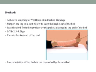 Method:
• Adhesive strapping or Ventfoam skin traction Bandage
• Support the leg on a soft pillow to keep the heel clear of the bed
• Pass the cord from the spreader over a pulley attached to the end of the bed
• 5-7lb(2.3-3.2kg)
• Elevate the foot end of the bed
• Lateral rotation of the limb is not controlled by this method
 
