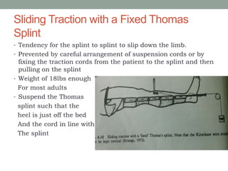 Sliding Traction with a Fixed Thomas
Splint
• Tendency for the splint to splint to slip down the limb.
• Prevented by careful arrangement of suspension cords or by
fixing the traction cords from the patient to the splint and then
pulling on the splint
• Weight of 18lbs enough
For most adults
• Suspend the Thomas
splint such that the
heel is just off the bed
And the cord in line with
The splint
 