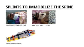 Comprehensive Guide to Splints and Tractions in Orthopaedics: Types ...