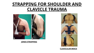 Comprehensive Guide to Splints and Tractions in Orthopaedics: Types ...