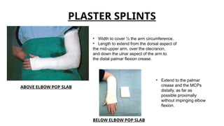 Comprehensive Guide to Splints and Tractions in Orthopaedics: Types ...