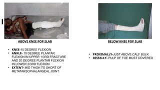 Comprehensive Guide to Splints and Tractions in Orthopaedics: Types ...