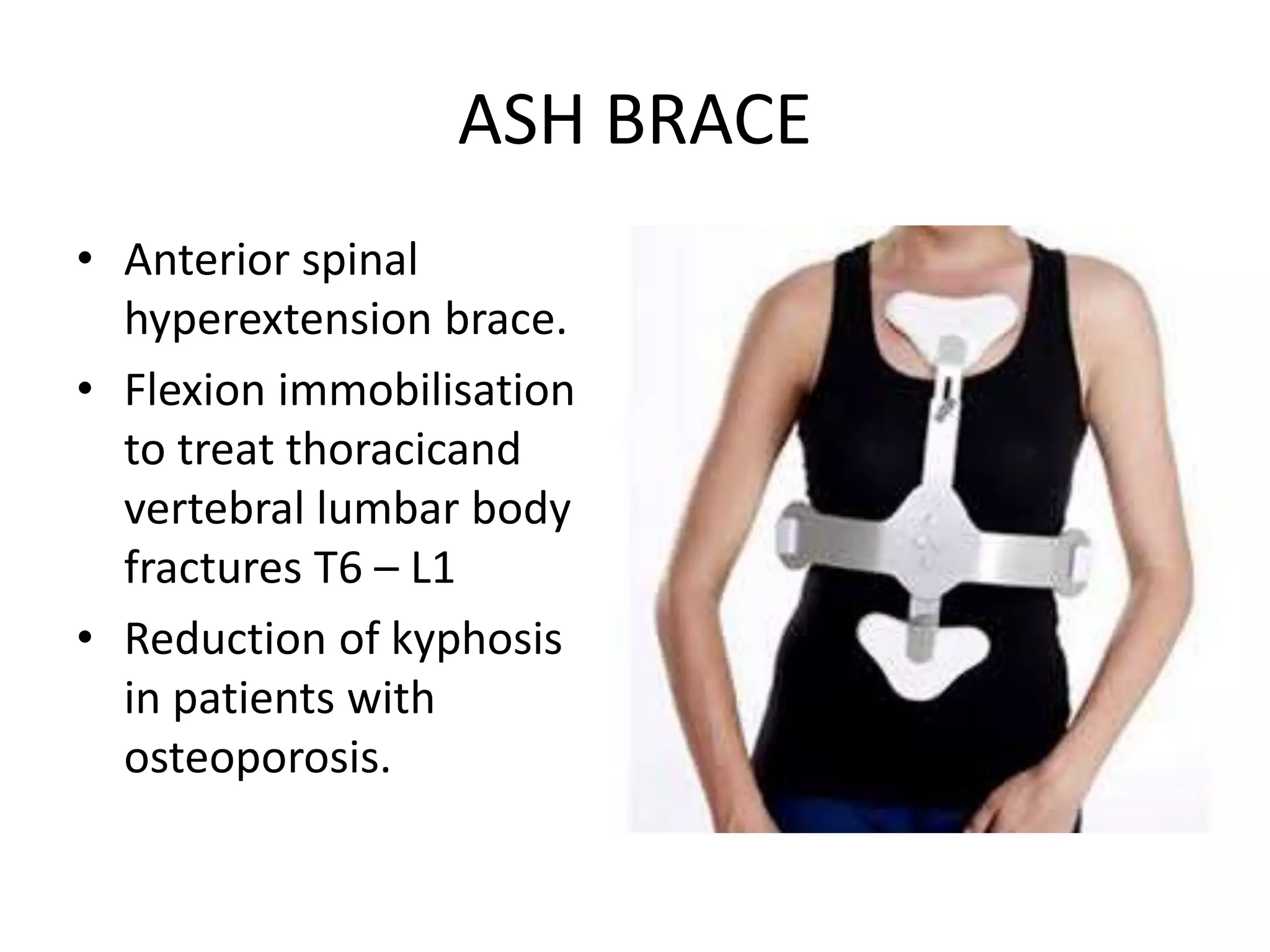 Splints and tractions in orthopedics | PPTX