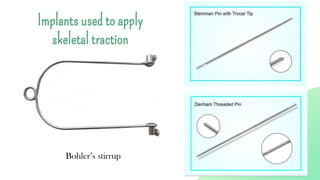 Implants used to apply
skeletal traction
Bohler’s stirrup
 