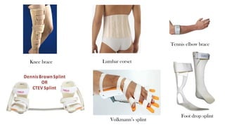 Foot drop splint
Knee brace
Volkmann’s splint
Lumbar corset
Tennis elbow brace
 