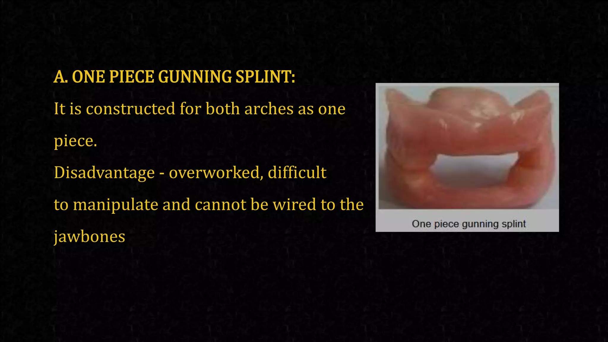 splints .pptx