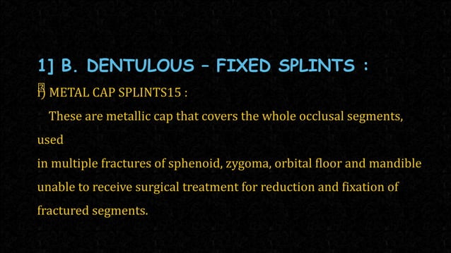 splints .pptx
