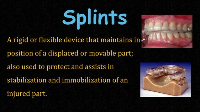 splints .pptx