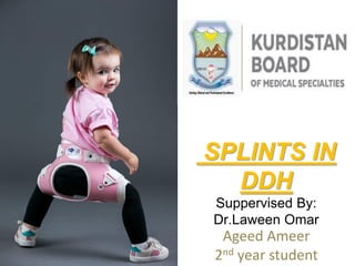 SPLINTS IN
DDH
Suppervised By:
Dr.Laween Omar
Ageed Ameer
2nd year student
 