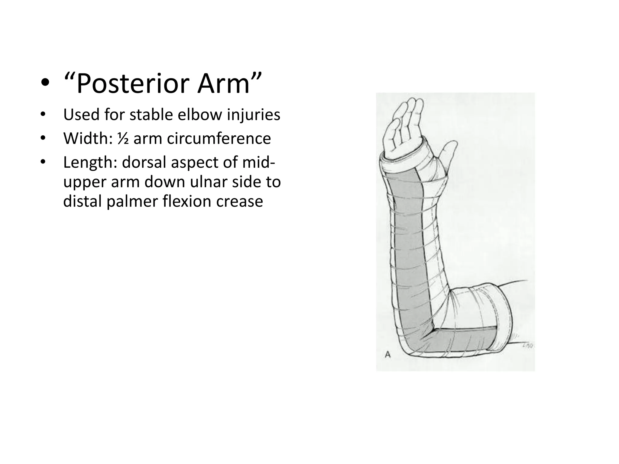 splint the children.ppt