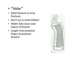 splint the children.ppt