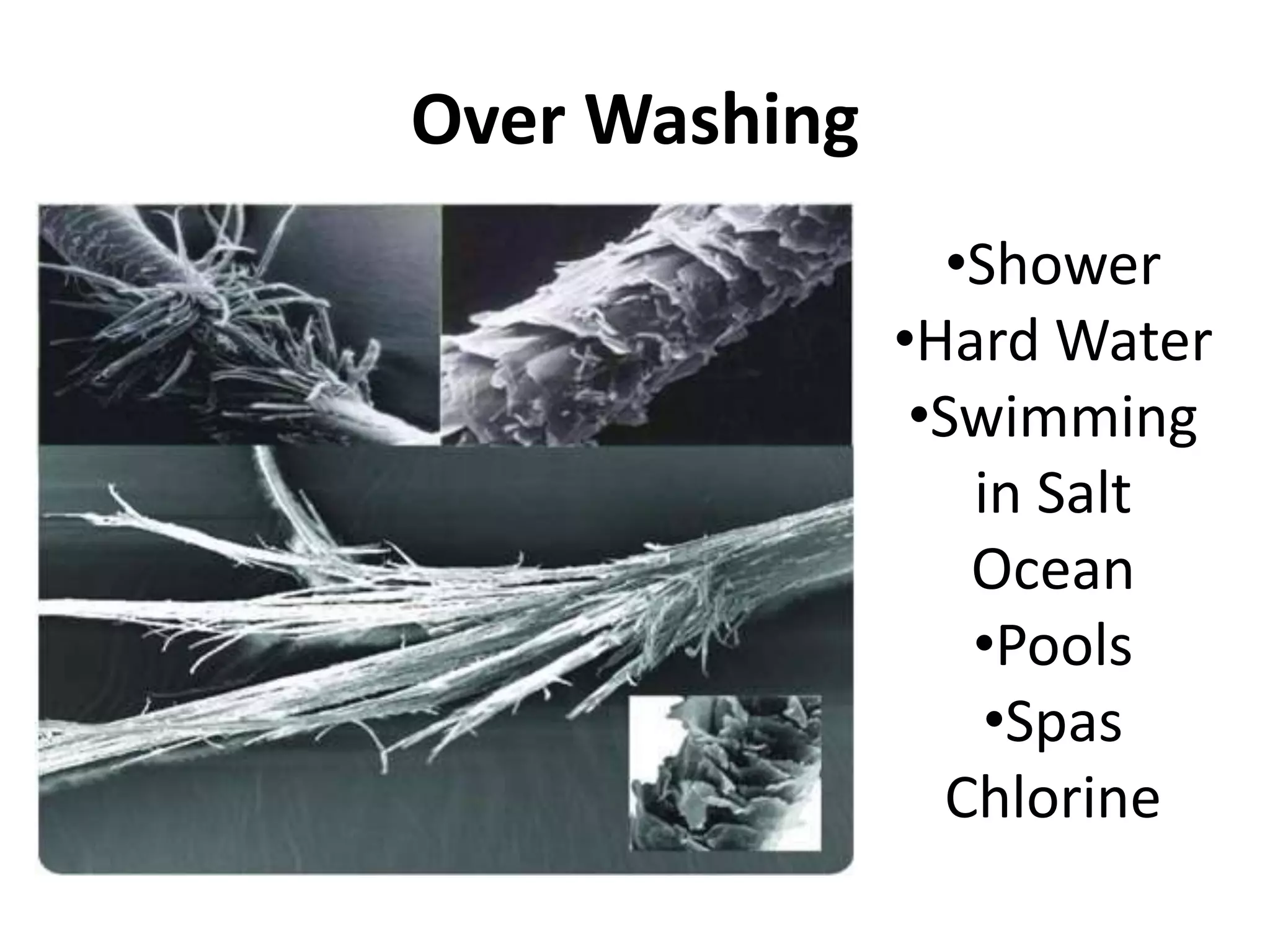 Over Washing 
•Shower 
•Hard Water 
•Swimming 
in Salt 
Ocean 
•Pools 
•Spas 
Chlorine 
 