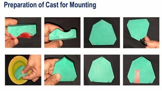 Split Cast Method SPLIT CAST TECHNIQUE for complete denture mounting | PPTX