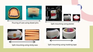 Split Cast Method SPLIT CAST TECHNIQUE for complete denture mounting | PPTX