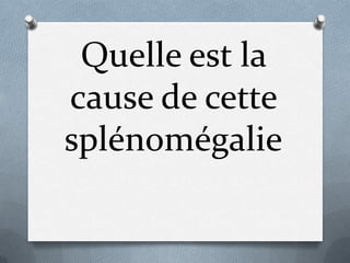 Quelle est la
cause de cette
splénomégalie
 