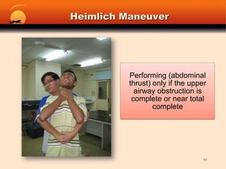 Heimlich Maneuver11