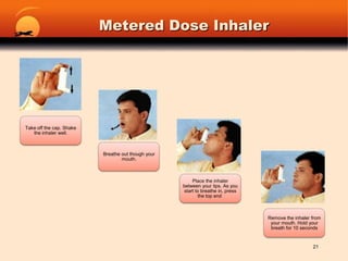 Metered Dose Inhaler21