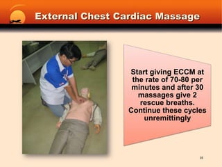 External Chest Cardiac Massage35